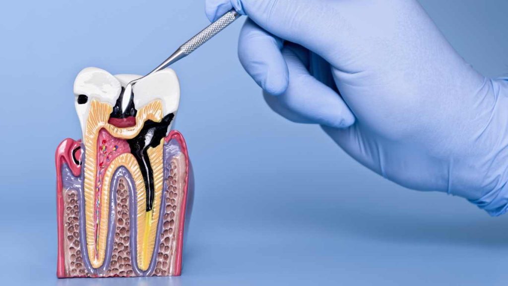 Clinica dental cumbres, odontólogo la unión, dentista la unión, odontopediatra la unión, ortodoncista la unión, rehabilitadora oral la unión, periodoncia, implantología la unión